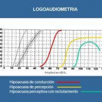 Logoaudiometria. 954301. Audiosalud (2022)